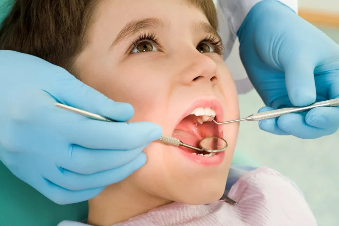 dental sealants
