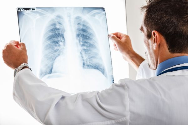 Doctor_1_