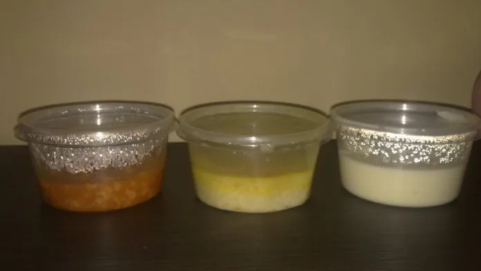 детска кухня