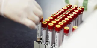 Шумен отново начело в Североизтока с 65 нови случаи на Ковид, в Търговище са 5, в Разград 7